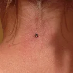 Un piercing en implant